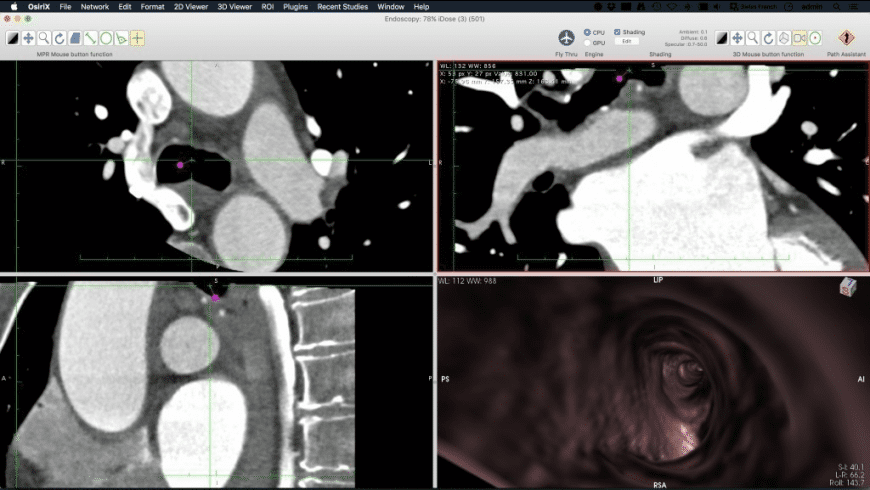 instal the new version for mac Sante DICOM Viewer Pro 12.2.5